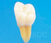 Oral Tooth Extraction